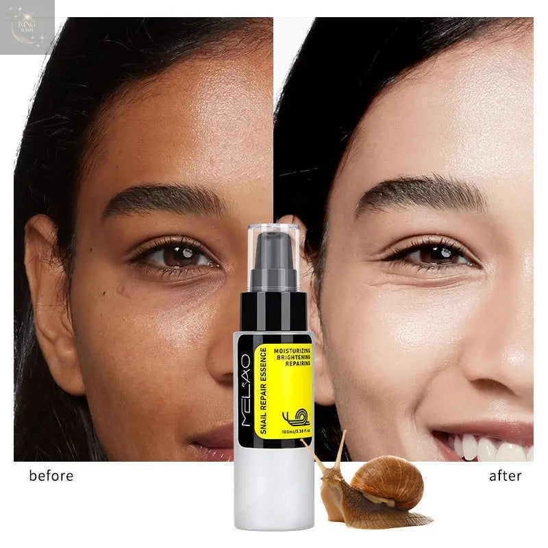 Snail Essence Facial Care Solution - King Wish